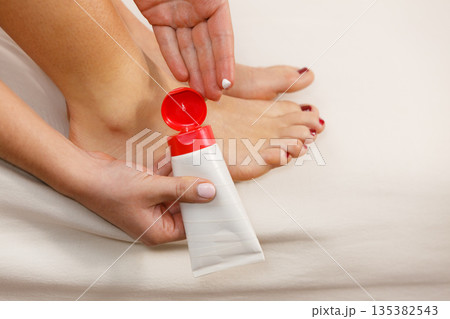 Woman putting ointment on bad ankle applying cream 135382543
