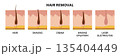 Hair removal methods. Hair, shaving, cream, waxing epilation, laser electrolysis 135404449