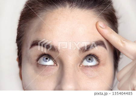 Caucasian woman portrait after botox injections, dysport. Woman points her finger at her forehead without wrinkles. Remarkable result after the procedure. Close up photo Caucasian woman portrait after botox injections, dysport. Woman points her finger at her forehead without wrinkles. Remarkable result after the procedure. Close up photo 135404485