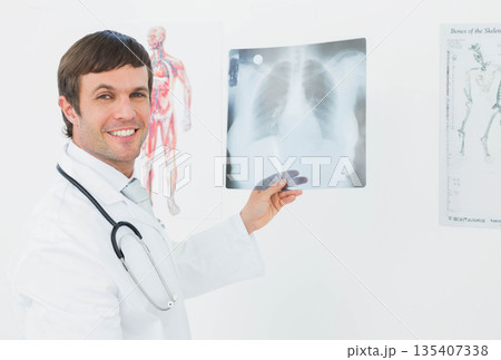 Male doctor holding chest X-ray film at eye level in examination room with stethoscope and posters 135407338