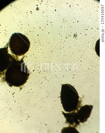 Microscopic image showing dark circular structures in biological sample under magnification used for research and scientific analysis in laboratory education and biology 135410097
