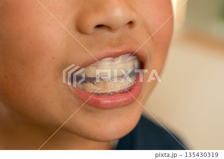 11 years old 135430319