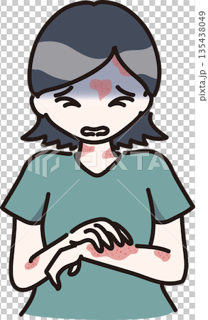 Illustration of a woman with hives allergy symptoms Illustration of a woman with hives allergy symptoms 135438049