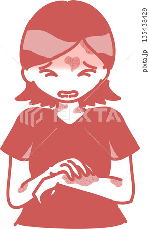 じんましんのアレルギー症状が出た女性のイラスト 単色 じんましんのアレルギー症状が出た女性のイラスト 単色 135438429