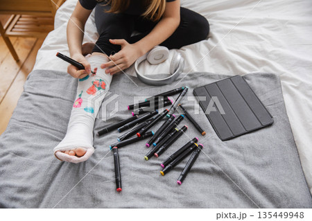 Woman hands drawing on broken leg cast. Unrecognizable girl draws with felt tip pens on orthopedic cast. Bored girl with broken leg playing at home during rehabilitation. Accident injury fracture Woman hands drawing on broken leg cast. Unrecognizable girl draws with felt tip pens on orthopedic cast. Bored girl with broken leg playing at home during rehabilitation. Accident injury fracture 135449948