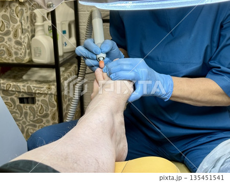 Hardware medical pedicure using a drill and nail files. A patient has a pedicure at a podiatrist. A dangerous fungal lesion of human toenails. Onychomycosis, treatment of nail fungus. Hardware medical pedicure using a drill and nail files. A patient has a pedicure at a podiatrist. A dangerous fungal lesion of human toenails. Onychomycosis, treatment of nail fungus. 135451541