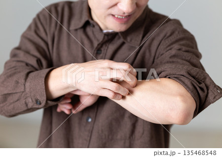 乾燥肌の痒みに苦しむミドル男性 135468548
