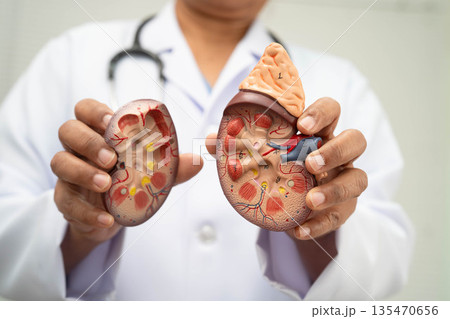 Chronic kidney disease, doctor with model for treatment urinary system, urology, Estimated glomerular filtration rate eGFR. 135470656