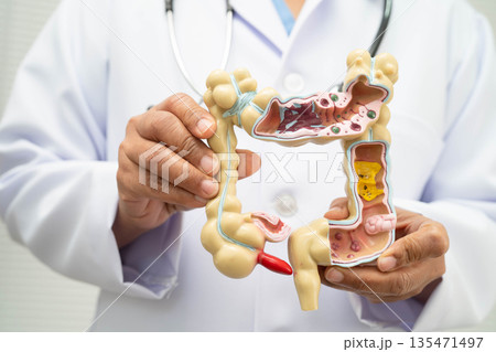Intestine, doctor holding human anatomy model for study diagnosis and treatment in hospital. 135471497