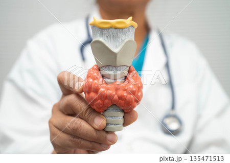Hyperthyroidism, Overactive Thyroid, Thyroid Lymphoma, Asian doctor with thyroid gland human anatomy model in hospital. Hyperthyroidism, Overactive Thyroid, Thyroid Lymphoma, Asian doctor with thyroid gland human anatomy model in hospital. 135471513
