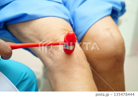 Asian doctor knock on knee reflex nerve for check and treatment senior patient in hospital. Asian doctor knock on knee reflex nerve for check and treatment senior patient in hospital. 135478444