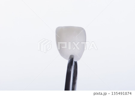 Ultra thin dental veneer isolated on white background macro dentistry restoration concept design Ultra thin dental veneer isolated on white background macro dentistry restoration concept design 135491874