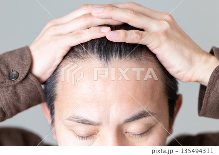 ミドル男性の髪の生え際 135494311