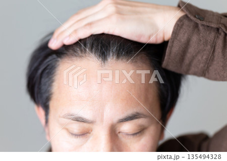 ミドル男性の髪の生え際 135494328