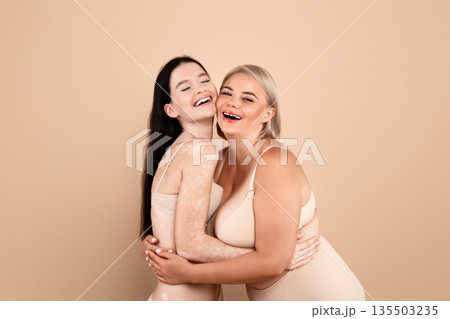 Portrait Of Two Happy Body Positive Women In Underwear Embracing And Laughing Together, Plus Size Lady And Female With Vitiligo Skin Disorder Posing Over Beige Studio Background, Copy Space Portrait Of Two Happy Body Positive Women In Underwear Embracing And Laughing Together, Plus Size Lady And Female With Vitiligo Skin Disorder Posing Over Beige Studio Background, Copy Space 135503235