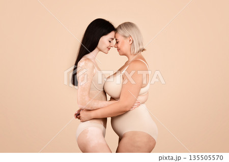 Side View Shot Of Two Body Positive Ladies Standing In Underwear, Young Plus Size Female And Woman With Vitiligo Skin Disorder Embracing And Touching Foreheads On Beige Studio Background, Copy Space Side View Shot Of Two Body Positive Ladies Standing In Underwear, Young Plus Size Female And Woman With Vitiligo Skin Disorder Embracing And Touching Foreheads On Beige Studio Background, Copy Space 135505570