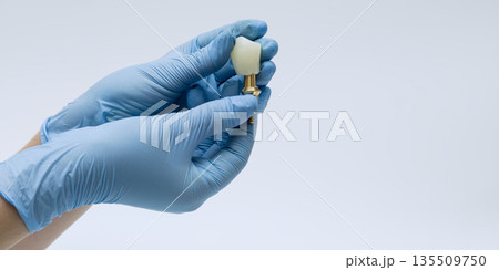 Gloved Hands Holding Dental Implant Crown Gloved Hands Holding Dental Implant Crown 135509750