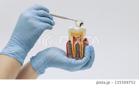 Gloved hands examining a tooth cross section model with dental mirror, showing internal tooth structure for dentistry education 135509752