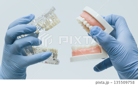 Comparison of dental prosthetic models in hands 135509758