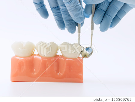 Dental professional with gloves holding mirror and probe tools over a healthy tooth model for inspection and training purposes. 135509763