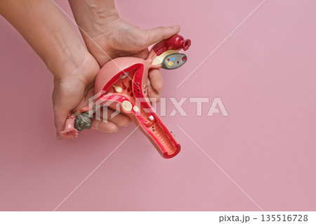 Anatomical model of the uterus in women's hands on a pink studio background. International Day of Action for Women Health Anatomical model of the uterus in women's hands on a pink studio background. International Day of Action for Women Health 135516728