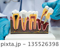Asian dentist holding dental implant, artificial tooth roots into jaw, root canal of dental treatment, gum disease, teeth model for dentist. 135526398