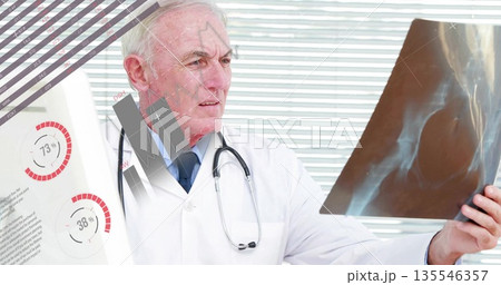 Doctor in lab coat with stethoscope holding up x-ray film and studying digital charts in office 135546357