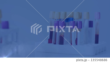 Presenting plastic test tube rack holding colored blood tubes on lab bench, with blurred equipment 135548686
