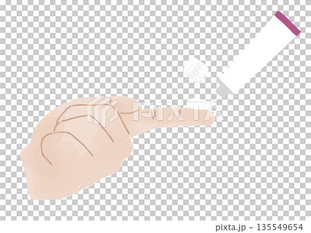 Illustration of 1 FTU ointment being dispensed onto a finger from a pink tube Illustration of 1 FTU ointment being dispensed onto a finger from a pink tube 135549654