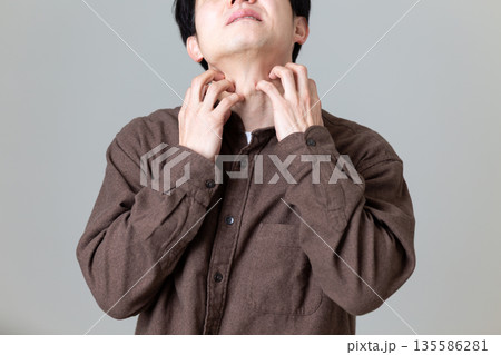 乾燥肌の痒みに苦しむミドル男性 乾燥肌の痒みに苦しむミドル男性 135586281