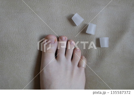 Silicone toe sleeve or cap. Woman puts on protective cover on little toe. Fights corns, prevents blisters and ingrown toenails Silicone toe sleeve or cap. Woman puts on protective cover on little toe. Fights corns, prevents blisters and ingrown toenails 135587372