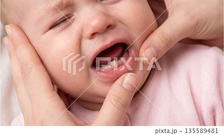 Baby with crying face receives comfort from adult during a teething moment at home in daytime 135589481