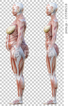 Muscle Anatomy Diagram: Comparison Illustration Set of Fat Female Anatomy Model and Thin Female Anatomy Specimen, Full Body Sideways Muscle Anatomy Diagram: Comparison Illustration Set of Fat Female Anatomy Model and Thin Female Anatomy Specimen, Full Body Sideways 135590218