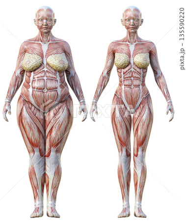 筋肉解剖図 太った女性の人体模型と痩せた女性の人体標本の比較イラストセット 全身正面 135590220