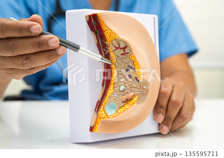 doctor holding female breast human anatomy model. 135595711