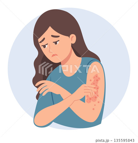 Sad woman scratches her hand. Allergic itching, skin inflammation, redness and irritation. Healthcare and medicine illustration. 135595843