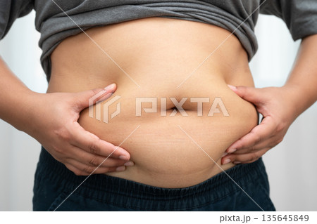 Asian woman use hand to squeeze fat belly big size overweight and obesity. Asian woman use hand to squeeze fat belly big size overweight and obesity. 135645849