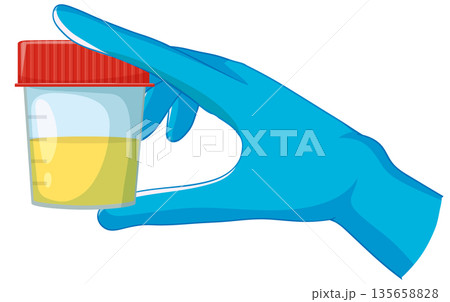 Gloved Hand Holding Urine Sample Container 135658828