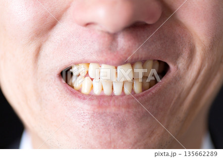 ミドル男性の歯 135662289