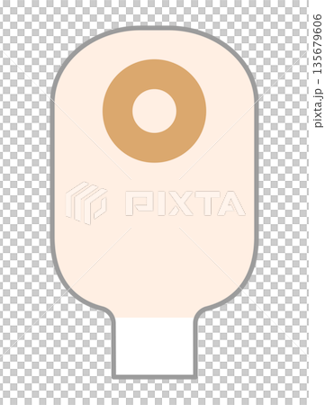 造口裝置示意圖 135679606