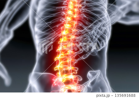 ぎっくり腰・腰痛の原因部位イメージ｜脊椎と神経のビジュアル表現 135691688