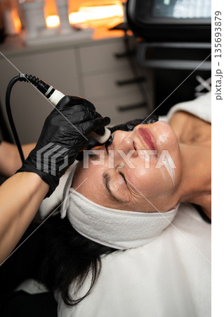 Close-up of RF lifting anti-aging treatment designed for senior woman skin rejuvenation and firmness improvement. 135693879