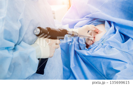 Arthroscope surgery. Orthopedic surgeons in teamwork in the operating room  135699615