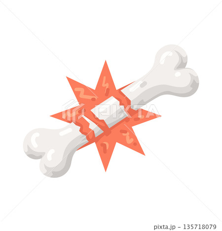 Illustration of Broken Bone 135718079
