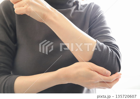 女性のひじ 135720607