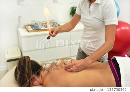 Young female physiotherapist applying glass suction banks on back of her patient, holding open flame above. Closeup detail of cupping therapy 135730562