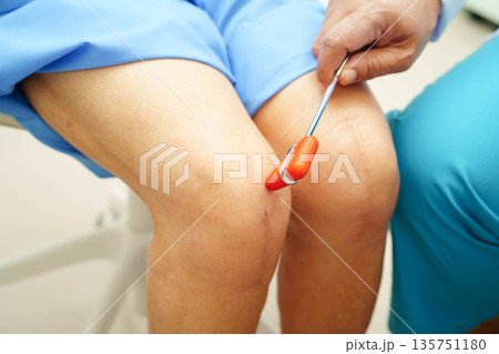 Asian doctor knock on knee reflex nerve for check and treatment senior patient in hospital. Asian doctor knock on knee reflex nerve for check and treatment senior patient in hospital. 135751180