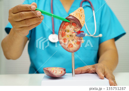 Chronic kidney disease, doctor with model for treatment urinary system, urology, Estimated glomerular filtration rate eGFR. 135751287