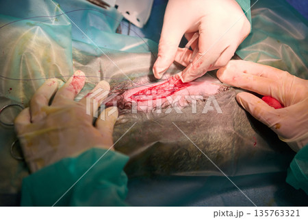 Surgical Operation On Patient With Sterile Gloves, Drapes, Visible Incision, And Team In Operating Room Surgical Operation On Patient With Sterile Gloves, Drapes, Visible Incision, And Team In Operating Room 135763321