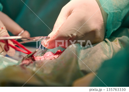 Surgeons In Green Scrubs Performing Detailed Surgical Procedure In Operating Room 135763330